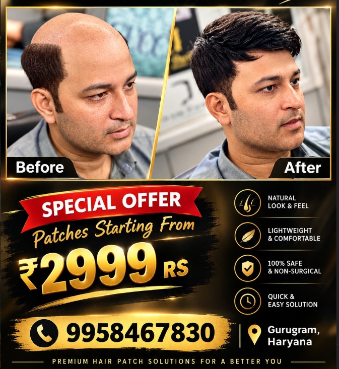 Special Offer Hair Patches starting from 2999