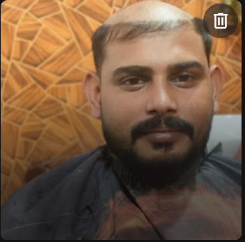 Client before hair patch at Aurelian Crown